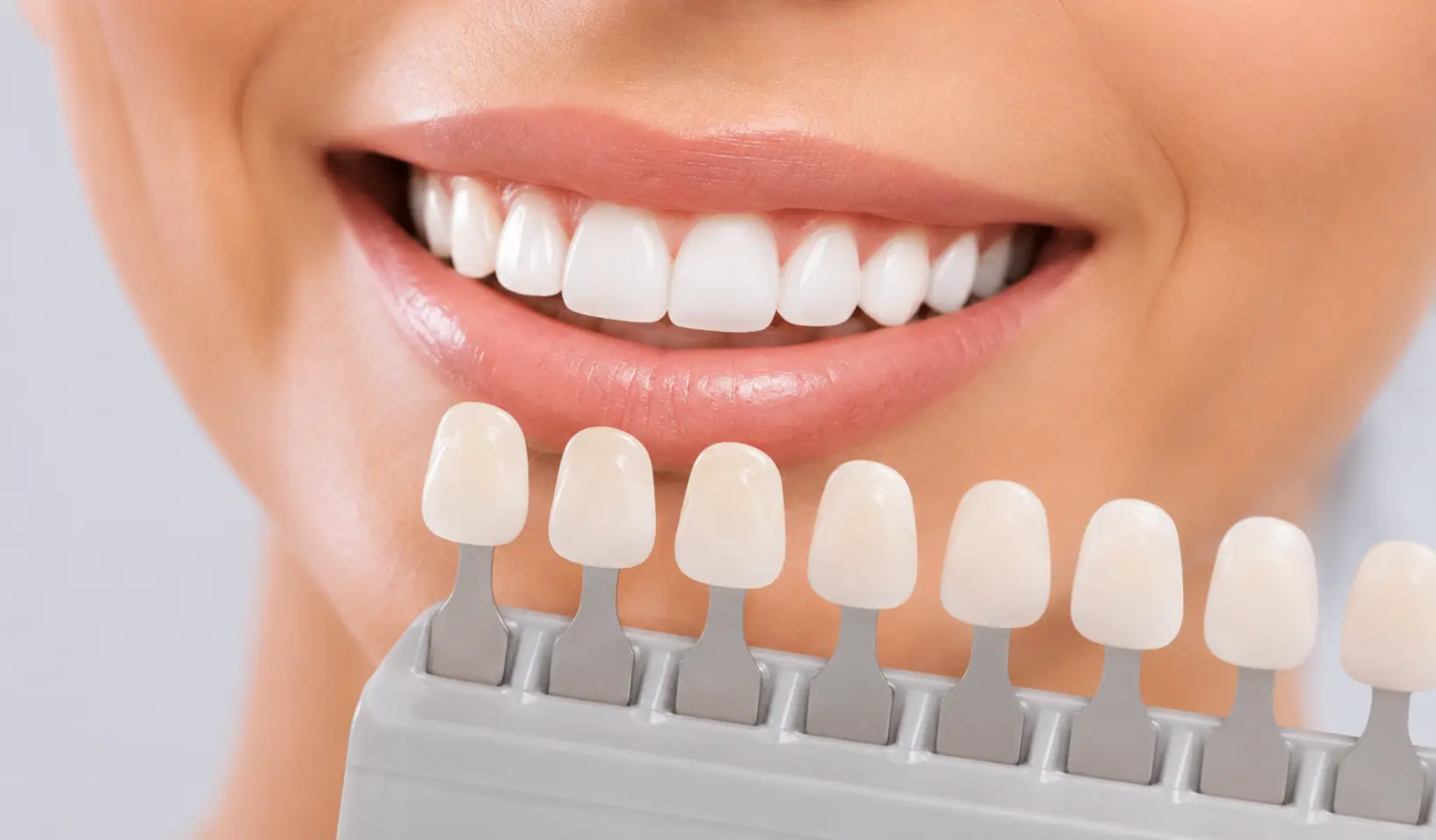 Teeth Whitening